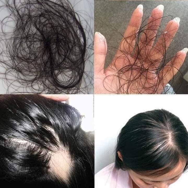 Dầu gội thảo mộc TKH