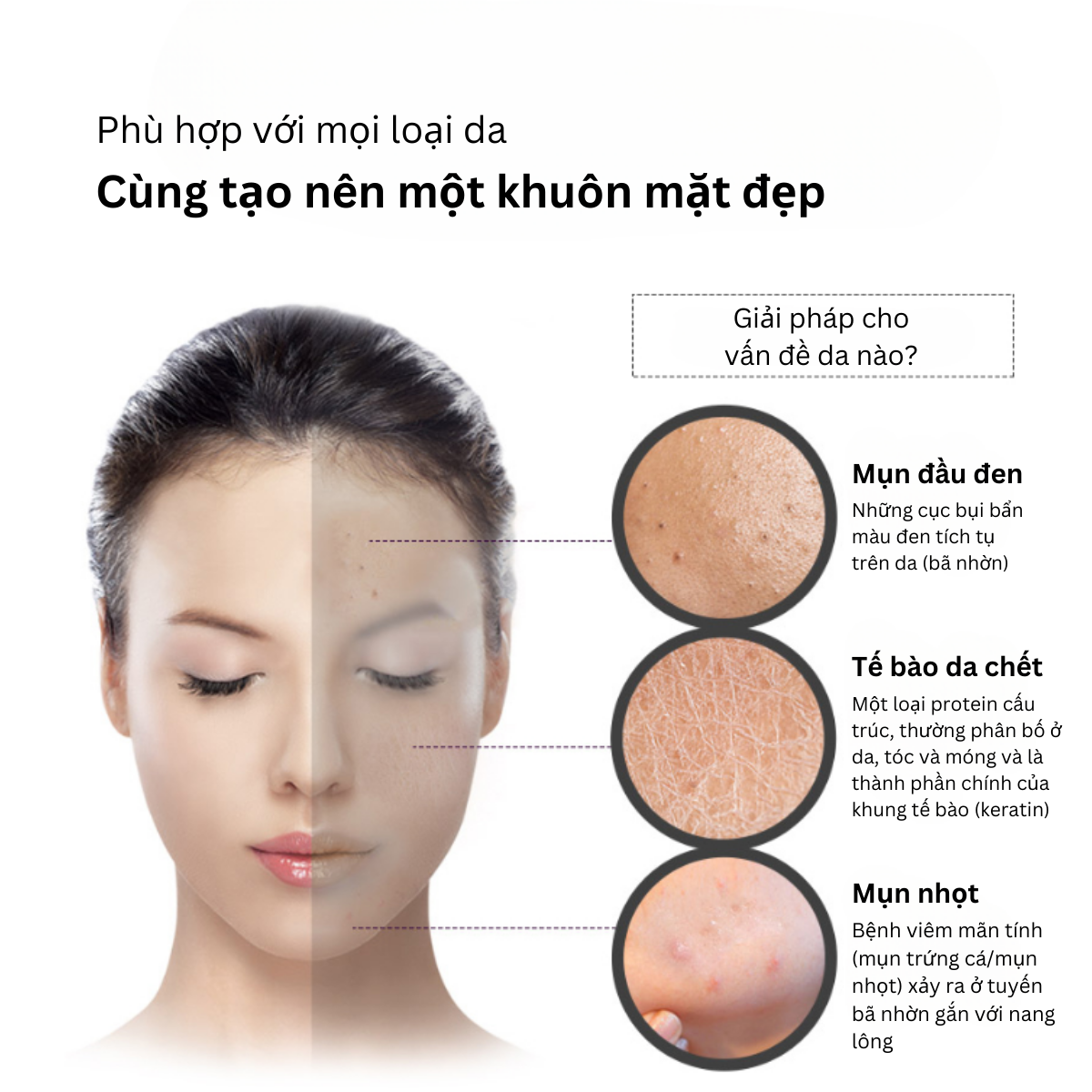 Purederm Mặt nạ sủi bọt than hoạt tính làm sạch da