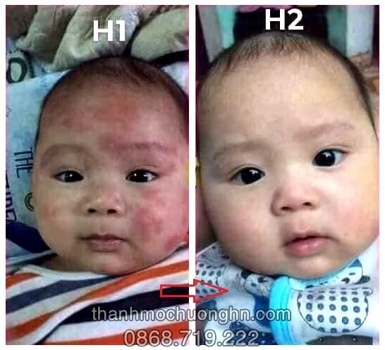 [HCM][CHÍNH HÃNG] Kem Bôi Da Thuần Mộc