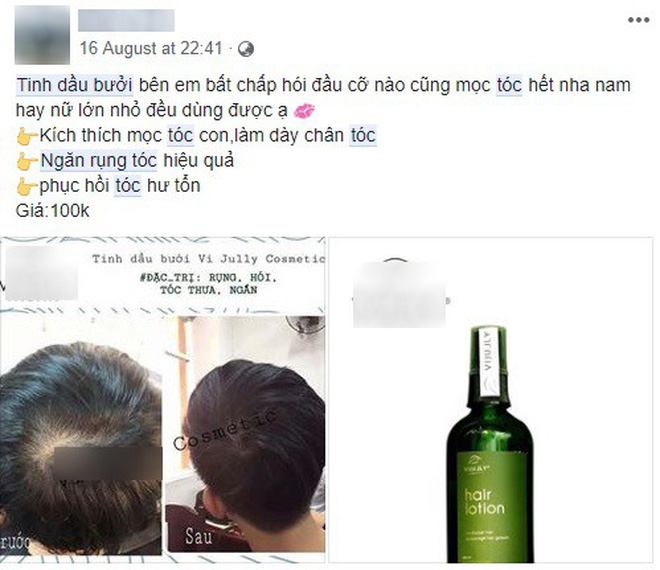 [HCM]Xịt bưởi Olic - ngăn rụng tóc mọc tóc hiệu quả kích thích mọc tóc