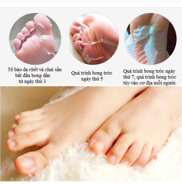 Mặt Nạ Ủ Chân Tẩy Tế Bào Chết