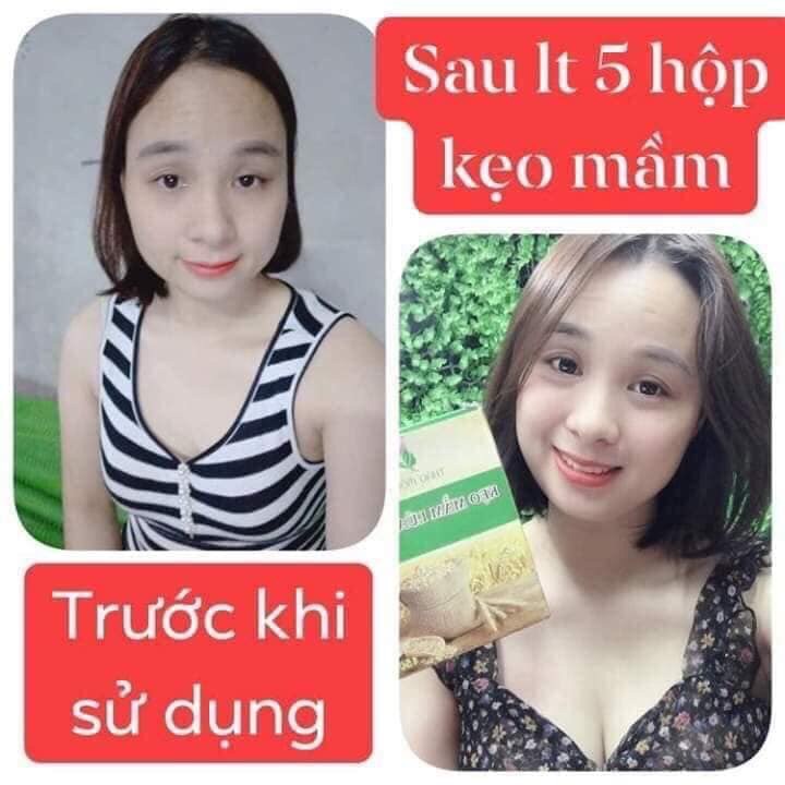 combo 5 hộp Kẹo mầm lúa mạch gold tăng size vòng 1