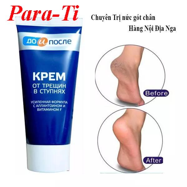 Kem chống nứt nẻ gót chân KPEM - Nga