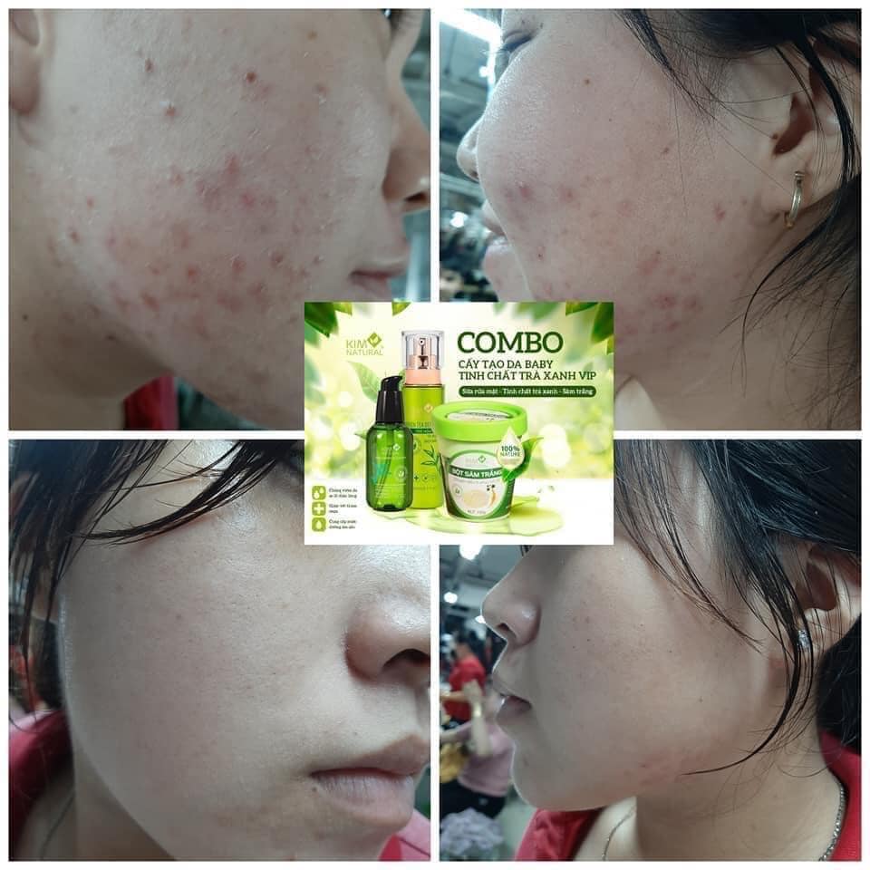 Tinh Chất Trà Xanh VIP Kim Natural