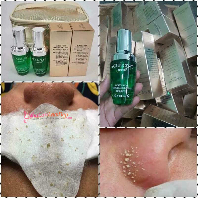 Ủ Mụn Young , ủ mụn cám , mụn đầu đen - Thỏ store