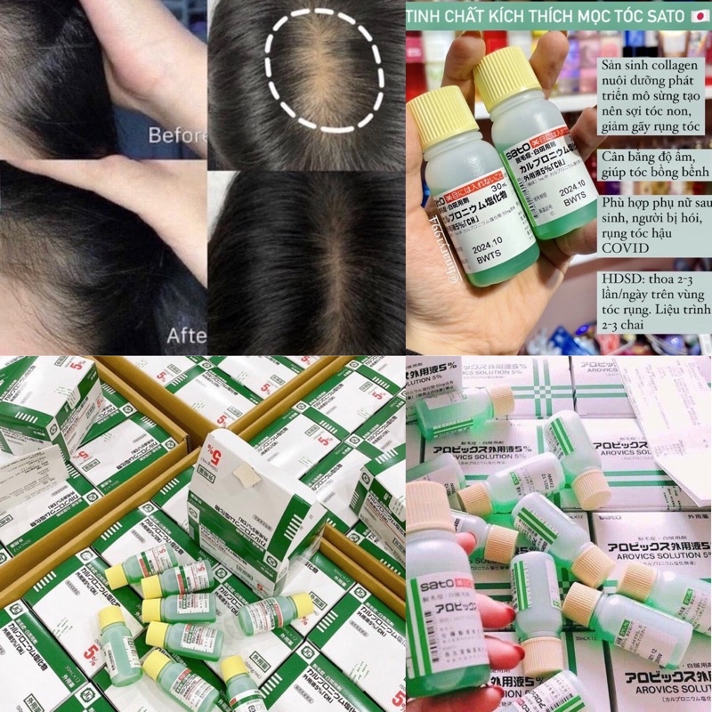 Tinh Chất Hỗ Trợ Mọc Tóc SATO - 30ml