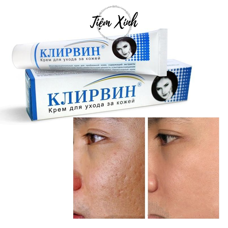 Kem trị sẹo của Nga Klirvin 25g kem trị sẹo lồi lõm, kem trị thâm mụn hiệu quả giá rẻ
