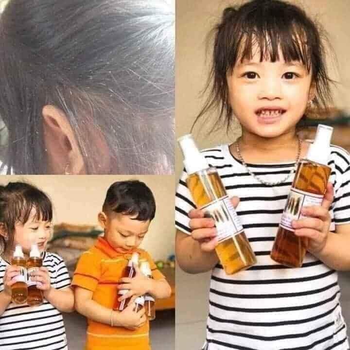 Ủ chấy một lần là hết chấy chí