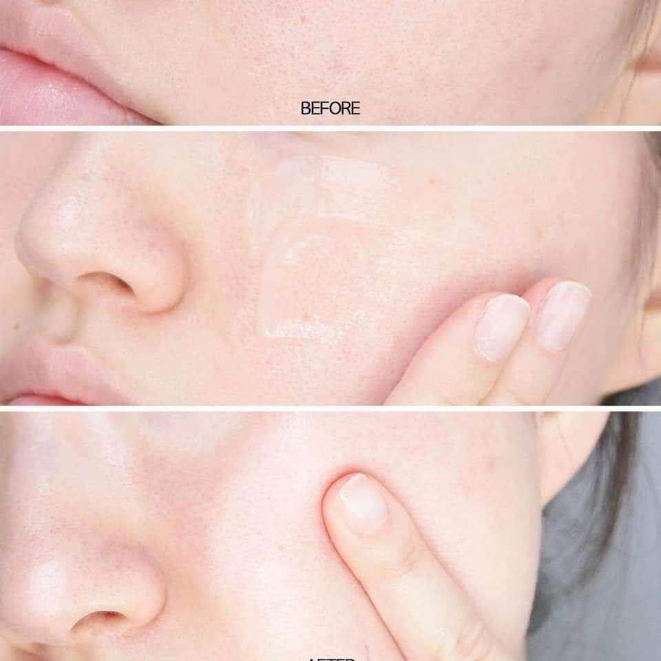 Kem dưỡng siêu cấp ẩm 100h Clinique.