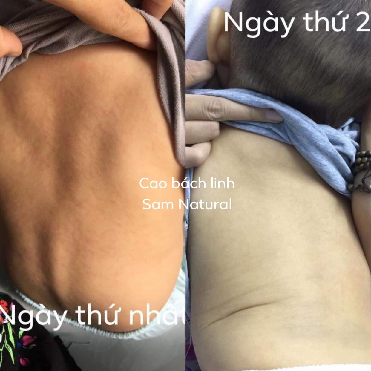 CAO LÁ BÁCH LINH SAM NATURAL