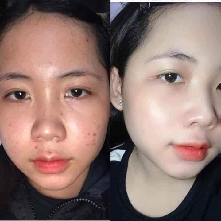 [HCM]Sữa Rửa Mặt Trà Xanh Hoa Đào