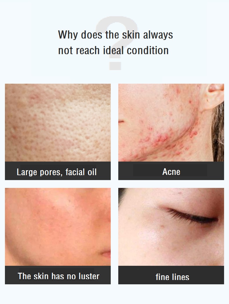 The Ordinary Glycolic Acid 7% Toning Solution - 240ml [NEW ARRIVAL]