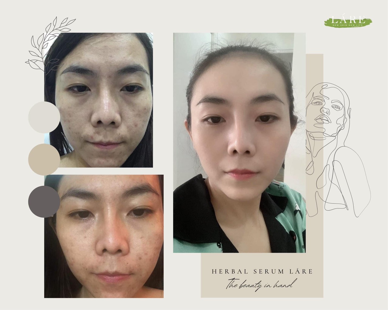 Serum Thảo mộc Thanh Dược Lare chiết lẻ 20ml