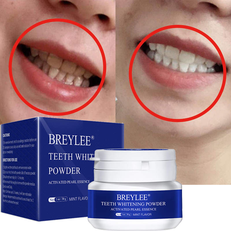 BREYLEE Bột trắng răng Làm trắng răng Chăm sóc răng Teeth Whitening White Pearl Powder nhập khẩu