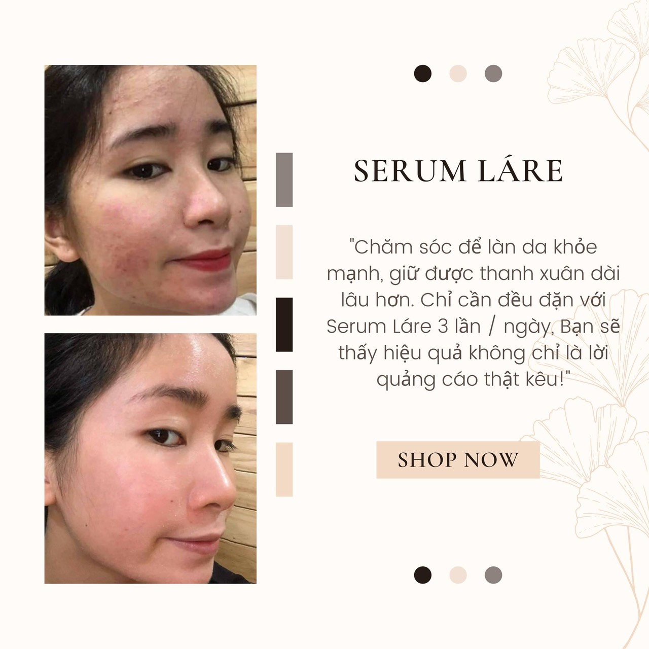 Serum Thảo mộc Thanh Dược Lare chiết lẻ 20ml