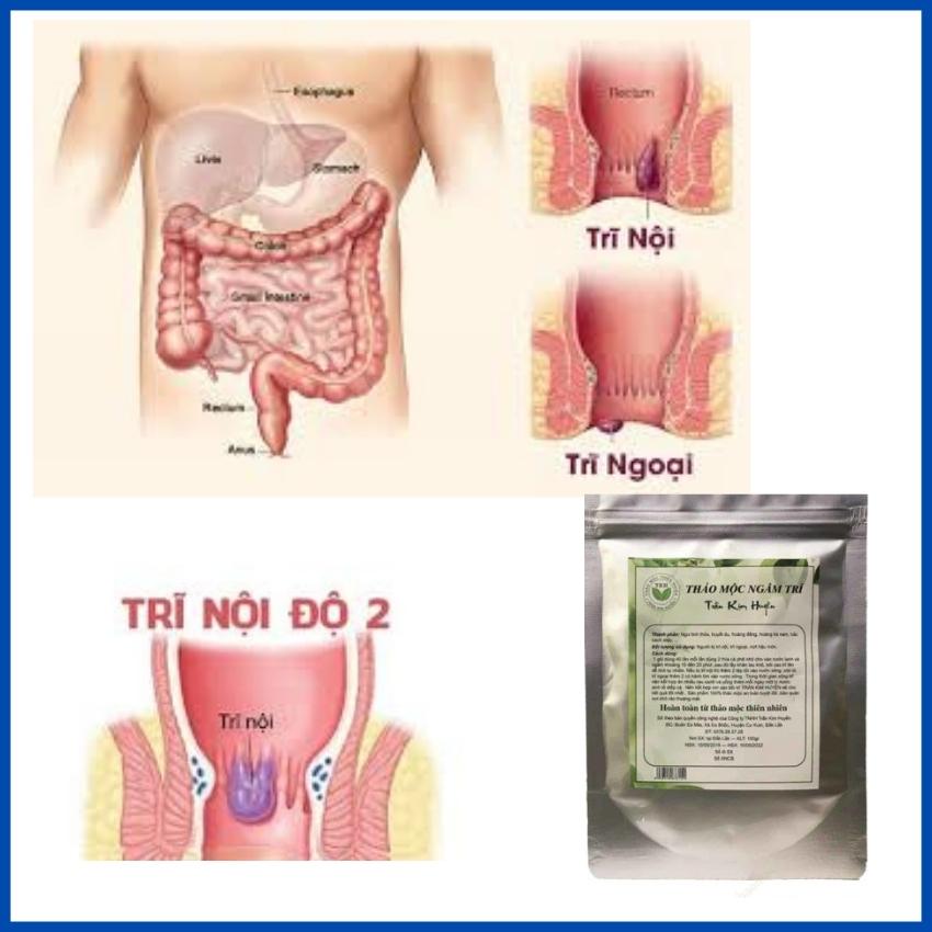Ngâm Trĩ Trần Kim Huyền