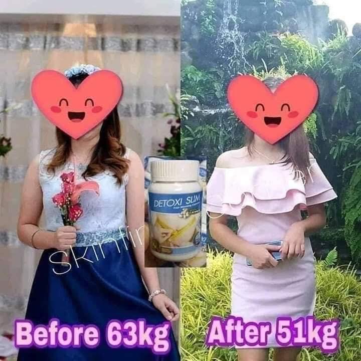 [HCM]Giảm mỡ bụng DETOXI SLIM