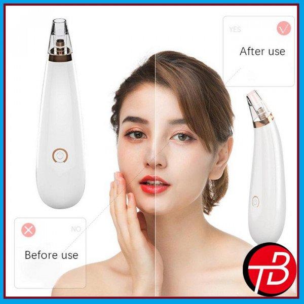 Máy hút mụn cầm tay mini