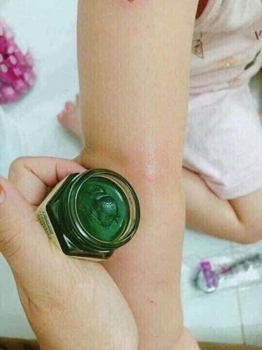 [Nhập RS0722 giảm 30k cho đơn 99k]Cao sả bôi muỗi Thái Lan
