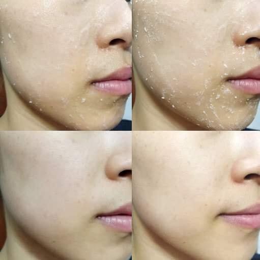 Gel tẩy tế bào chết