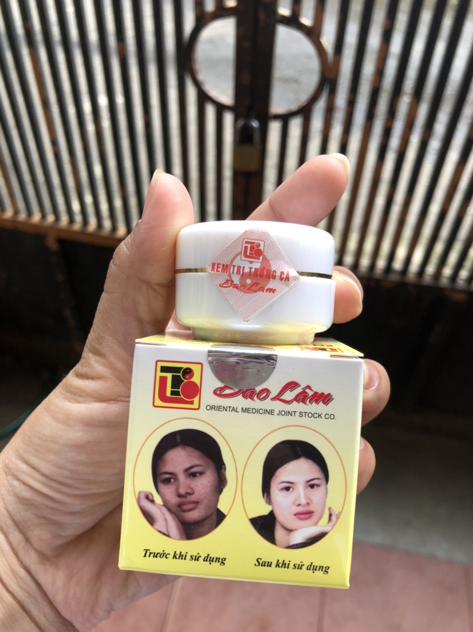 Kem dưỡng trắng da, mụn thâm - Bảo Lâm