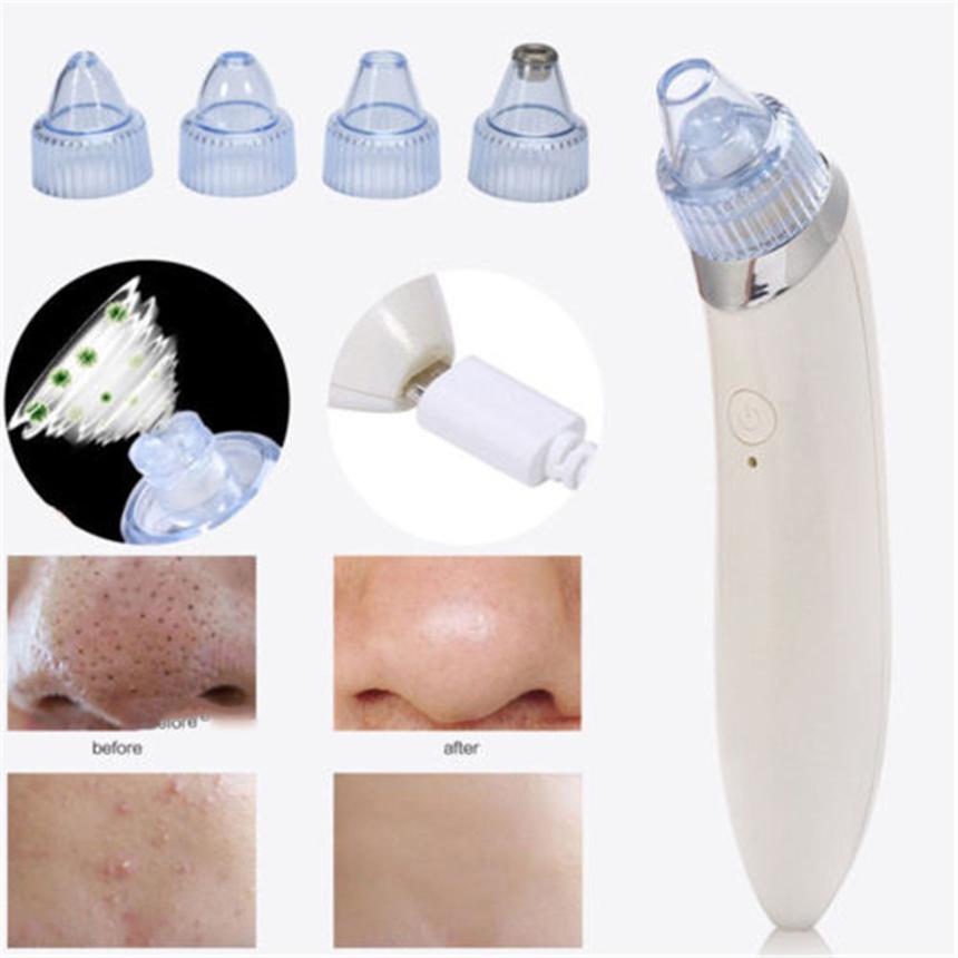 Máy hút mụn mini cầm tay-máy hút mụn siêu mạnh-siêu sạch- làm căng da- xóa nếp nhắn-máy hút mụn an toàn-máy hút mụn tiện lợi- không tác dụng phụ-máy hút mụn rt-8080,xn-8030 hàng hot nhất năm-được bán bởi công nghệ 10-10