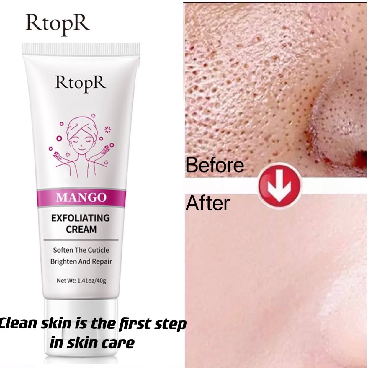 RtopR Kem tẩy tế bào chết làm sạch da mặt. loại bỏ mụn đầu đen dưỡng da mặt giá siêu tốt