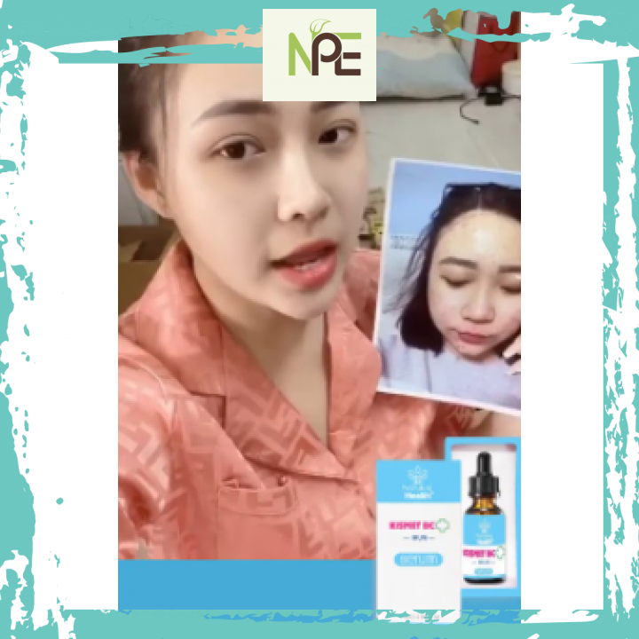 [HCM]Serum hỗ trợ giảm mụn Kismet BC