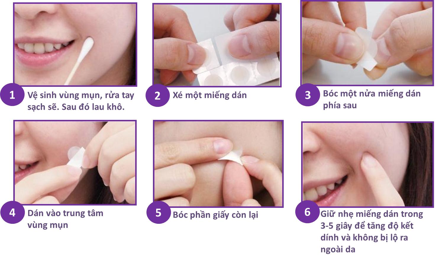 MIẾNG DÁN MỤN NEXCARE ( HỘP/30 MIẾNG)