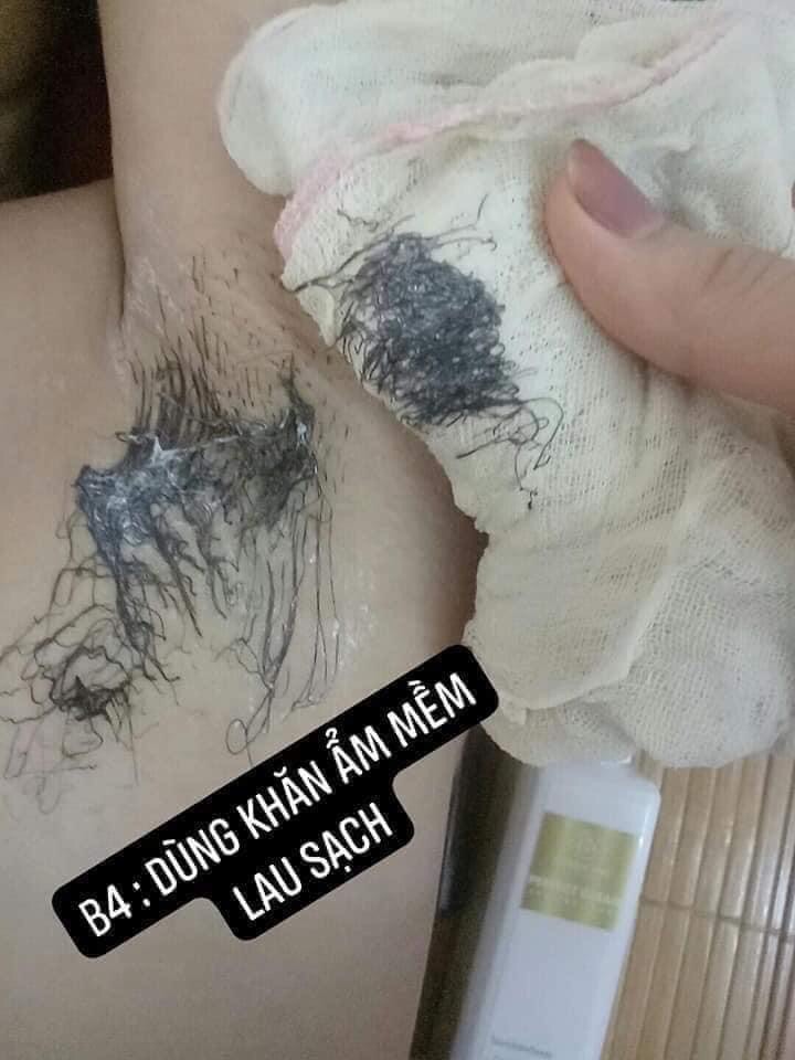 [HCM]Tẩy lông triệt lông perfect clean - tẩy lông Huyền phi