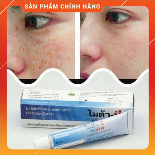 Kem khử nám myda -b thái lan tuýp 15gram chuyên khử nám chuyên sâu , tàn nhang hiệu quả