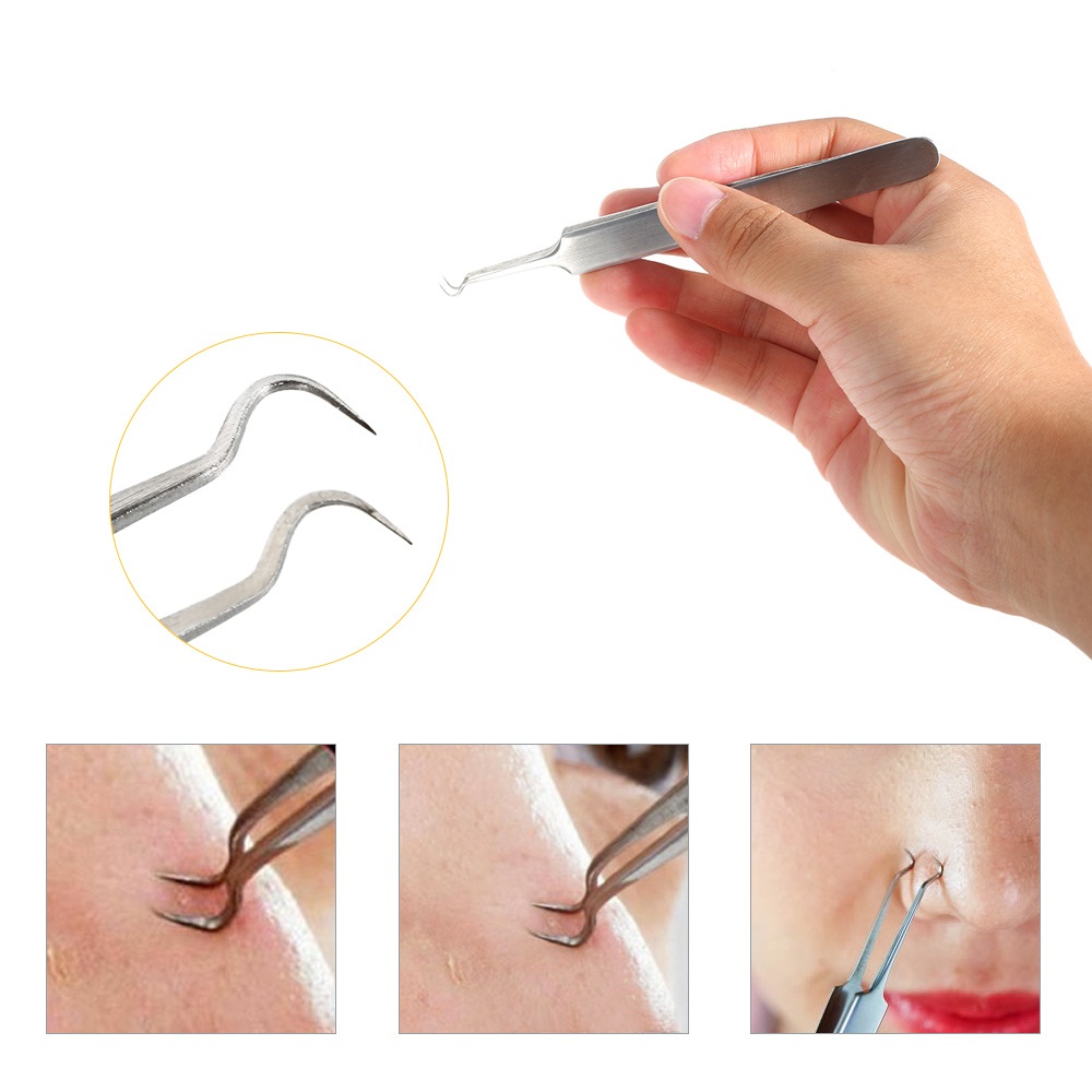 Nhíp gắp mụn đầu đen Vacosi T07