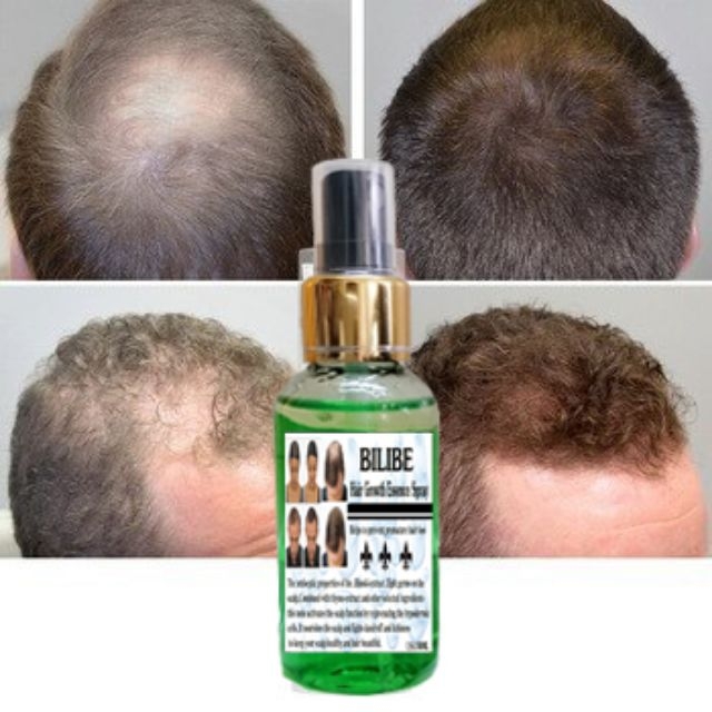 [HCM]Serum Mọc Tóc Dài Tóc Nam Nữ