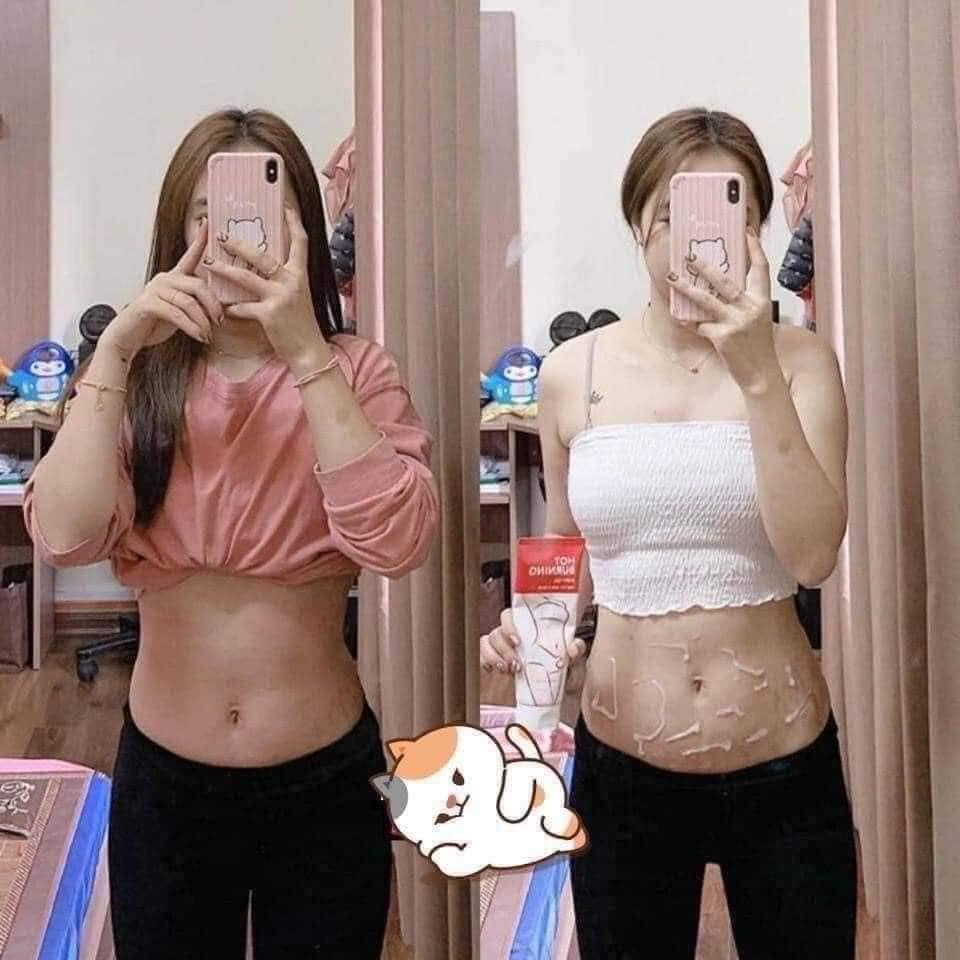 Kem tan mỡ bụng 𝐌𝐢𝐬𝐬𝐡𝐚 𝐇𝐨𝐭 𝐁𝐮𝐫𝐧𝐢𝐧𝐠 𝐏𝐞𝐫𝐟𝐞𝐜𝐭 𝐁𝐨𝐝𝐲 𝐆𝐞𝐥 𝟐𝟎𝟎𝐦𝐥