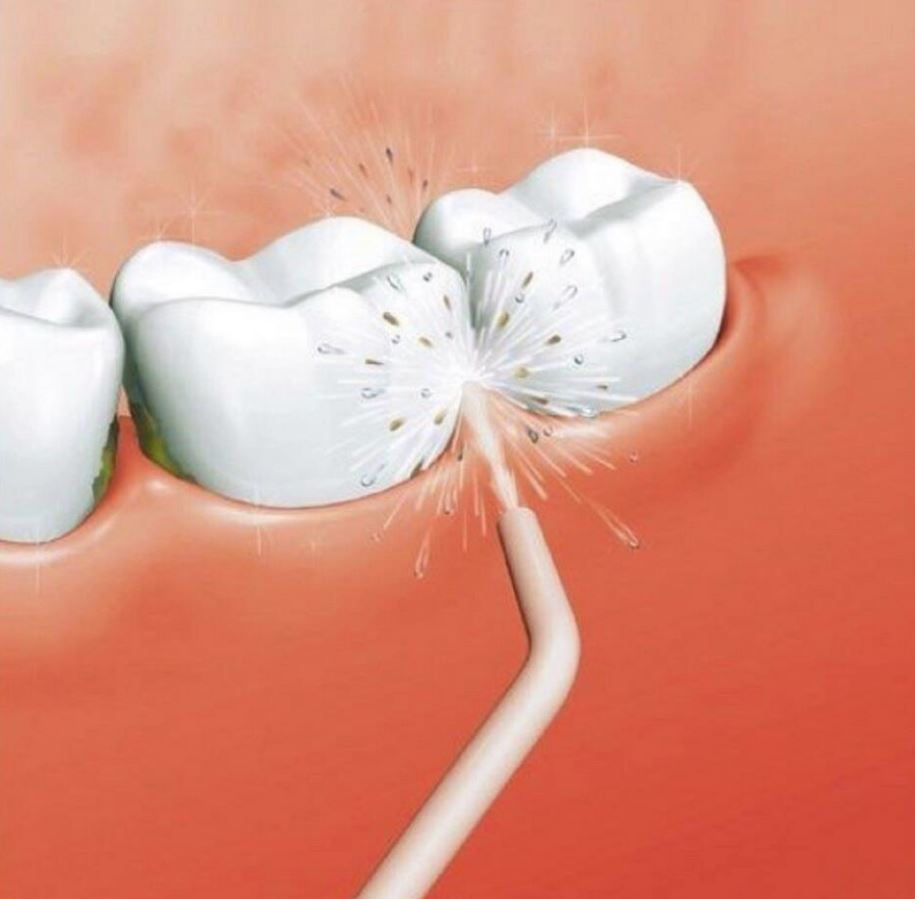 [HCM]Bình Xịt Tăm Nước Vệ Sinh Răng Miệng