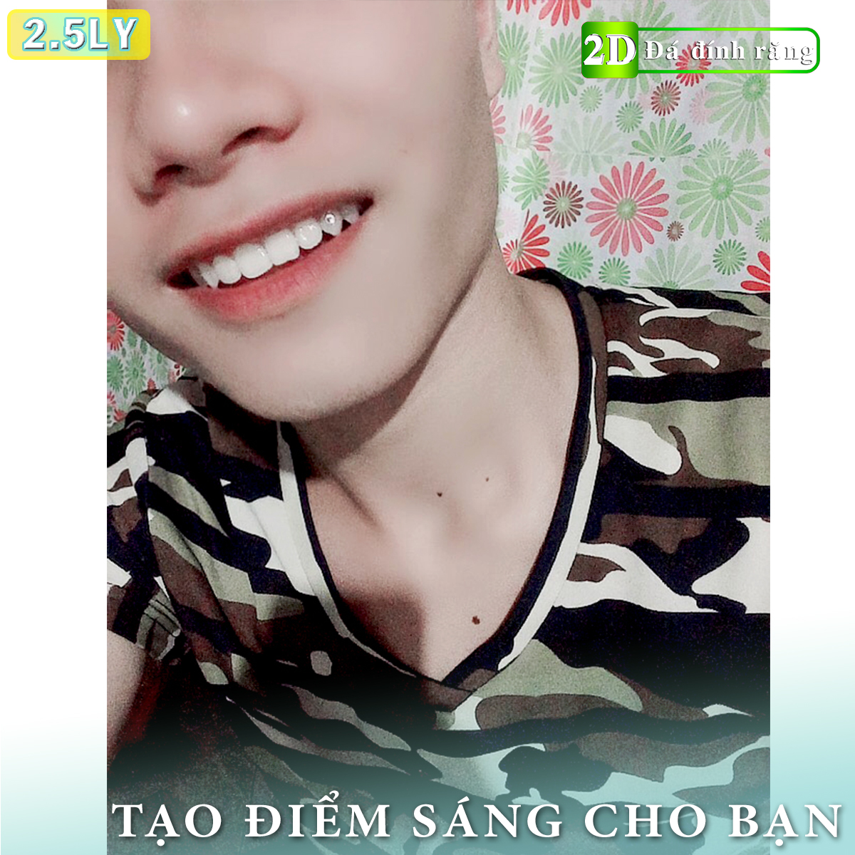 [HCM] Đá dán răng loại vừa (5 viên 2.5LY + keo dán + bút gắn)