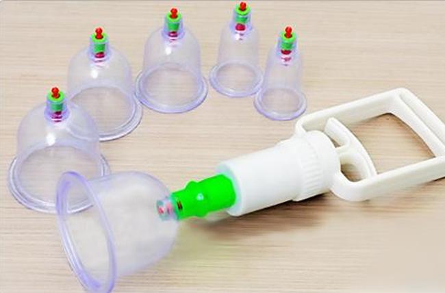 Bộ giác hơi - Freeship- ống hút giác hơi chân không 12 ỐNG Không Cần Dùng Lửa