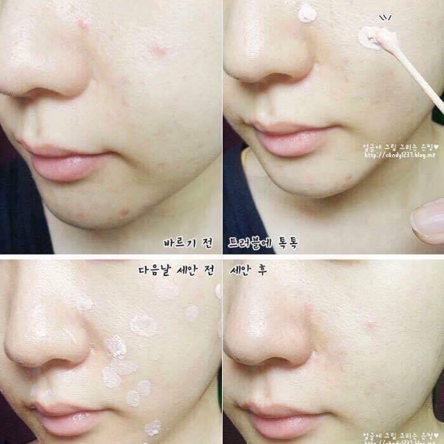 Dung Dịch Chấm Mụn Mario Badescu Drying Lotion