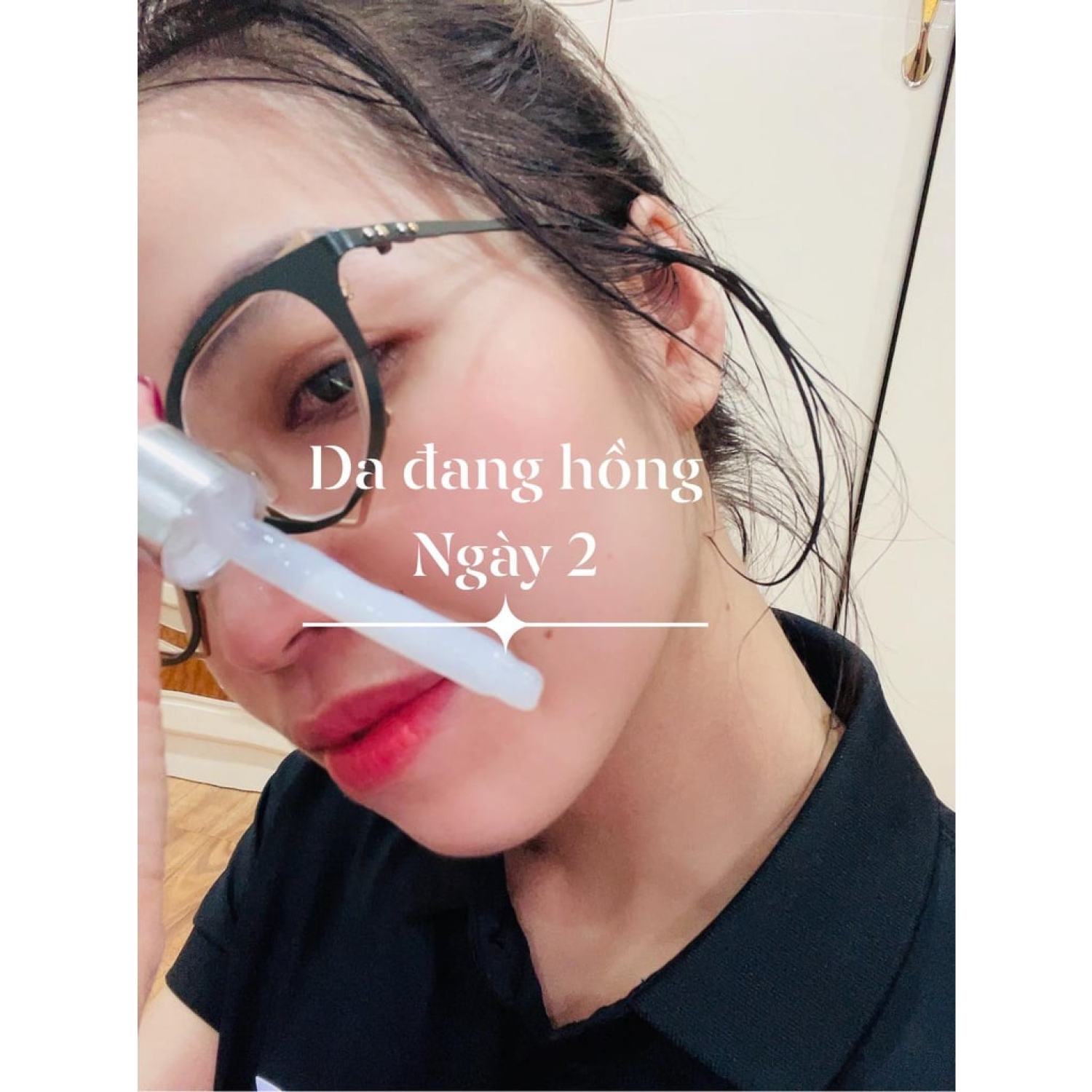 Bách Y Sâm 03 Plus CHUYÊN NÁM 30ML (Mẫu Mới Của Bạch Linh 3)