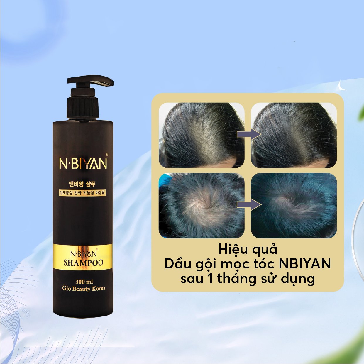Dầu Gội Mọc Tóc NBIYAN