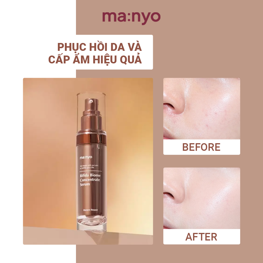 Tinh Chất Trẻ Hoá Da Manyo BIFIDA BIOME CONCENTRATE SERUM 35ml
