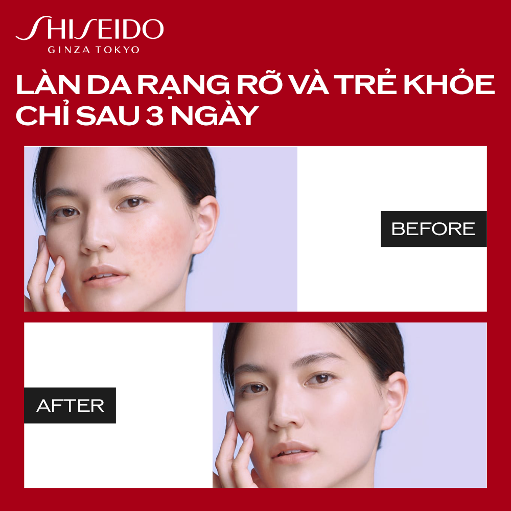Tinh chất (serum) dưỡng da Shiseido Ultimune Power Infusing Concentrate 75ml