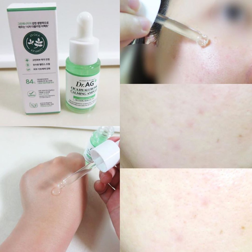 [SẴN] Tinh Chất DR.AG+ Cica Hyaluronic Calming Ampule.