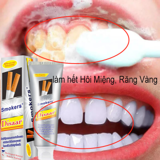 làm trắng răng nhanh chóng Kem Đánh Răng Disaar Thái Lan Tẩy Ố Vàng Răng, Làm Trắng Răng, làm hết Hôi Miệng, Răng Vàng,hiệu quả nhanh.nam nữ đều có thể sử dụng,sản phẩm được nâng cấp tác dụng mạnh hơn thumbnail
