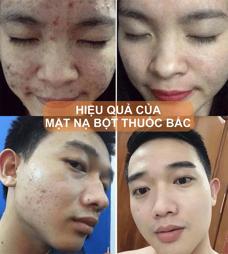 1KG Bột tthuốc bắc (mặt nạ và tắm trắng) - Tặng 100G bột trà xanh.