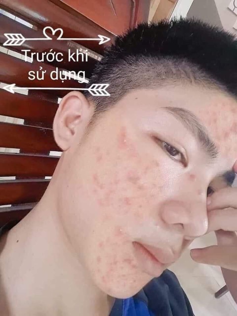 Combo 5 hộp Kem sâm cô tiên Thái Lan - [NOON Fashion]