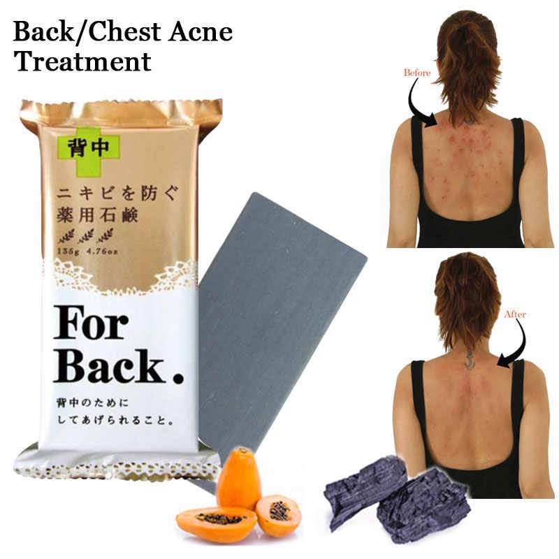 Xà phòng giảm mụn lưng For back của Nhật