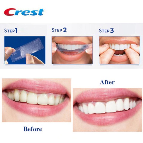 [HOÀN TIỀN 15%] [Bill Mỹ] Miếng Dán Trắng Răng Crest 3D White Glamorous - Professional - 1 Hour - Charcoal [SeeMe beauty]