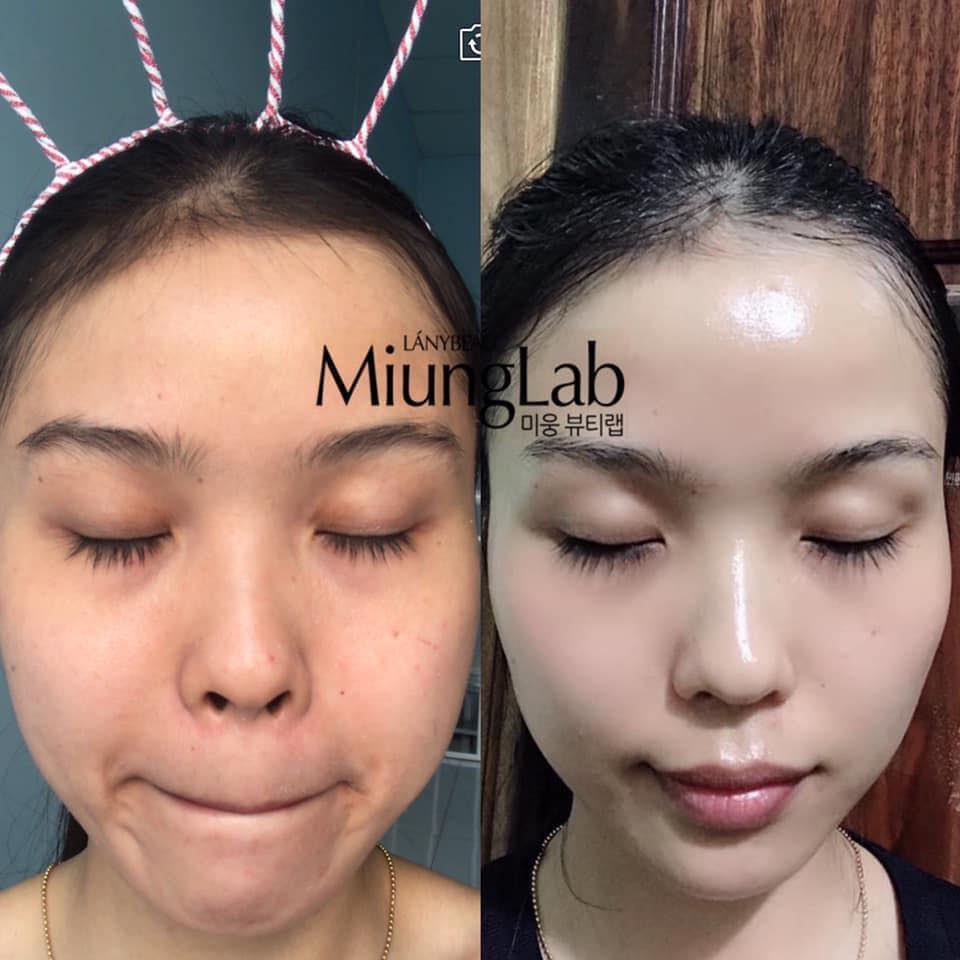 [HCM]MẶT NẠ DỪA MIUNG LAB COMBO 2 MIẾNG