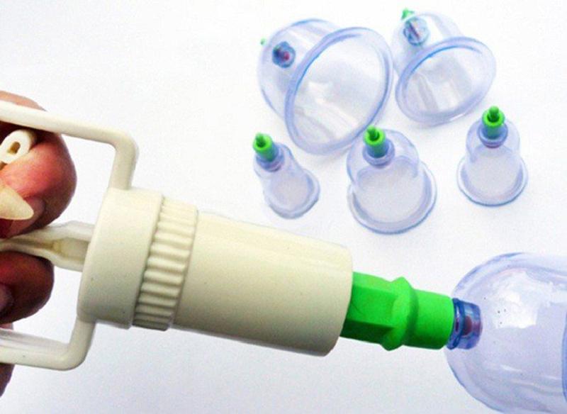 [HCM]BỘ DỤNG CỤ GIÁC HƠI -KHÔNG DÙNG LỬA - 12 Ống